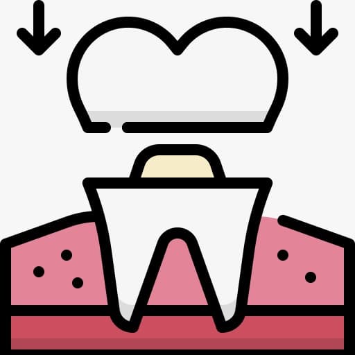Dental Crowns